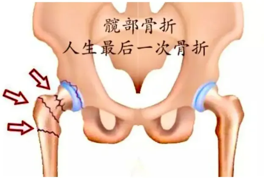 1718189330815344.png image.png